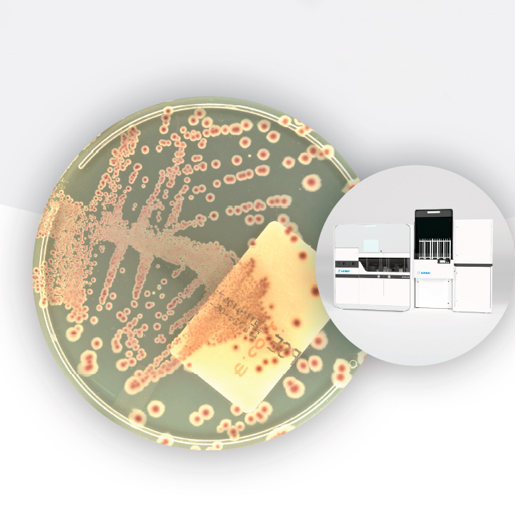 Infecciones urinarias inteligencia artificial - 
Urinary tract infections IA