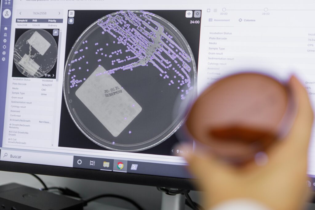 Módulo de IA para Cultivos de Orina en Aiplak - Urine Culture AI Module for Aiplak